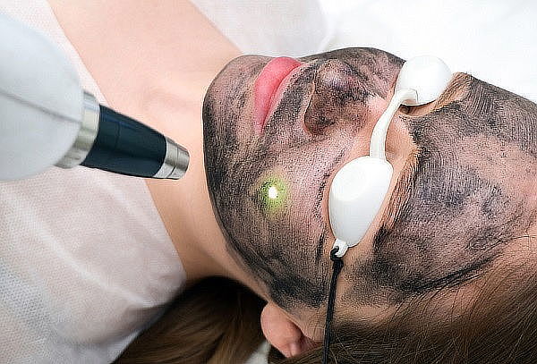 Hollywood Peel + Limpieza facial 1 Sesión