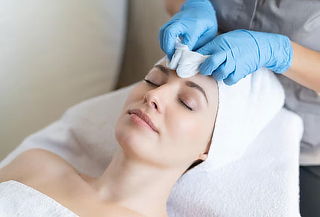 Peeling Químico Renovación Total  en Clínica Vitaplace