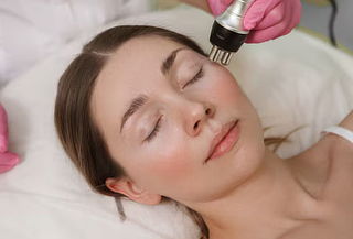 Rejuvenecimiento facial con radiofrecuencia en Sunrise