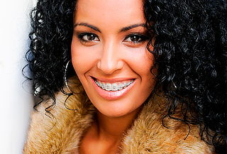 Evaluación Frenillos Metálicos o Cerámicos, Stgo Centro