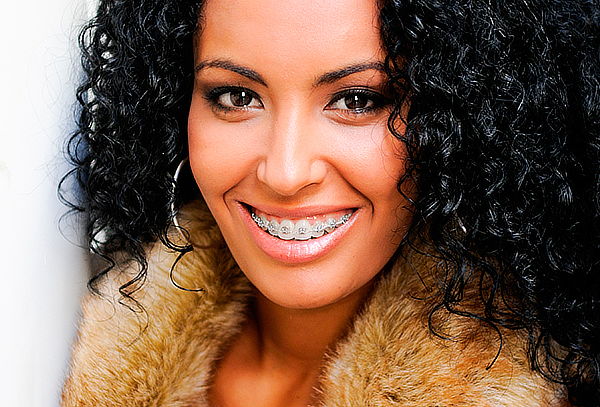 Evaluación Frenillos Metálicos o Cerámicos, Stgo Centro