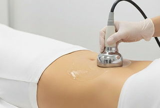 Tratamiento Reductivo: Cavitación + Presoterapia 6 o 12 Ses