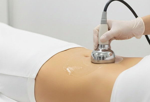 Tratamiento Reductivo: Cavitación + Presoterapia 6 o 12 Ses