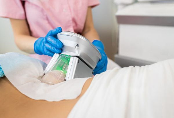 1 o 2 Sesiones de Criolipolisis en Zona a Elección + Ondas 