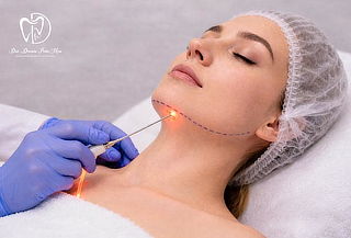 Gift Card de Liposucción de papada + endolaser