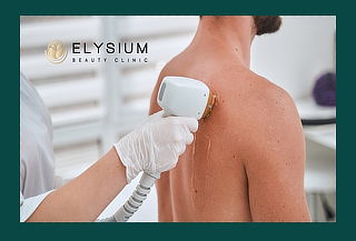 3S de Depilación Láser CUERPO COMPLETO en La Dehesa