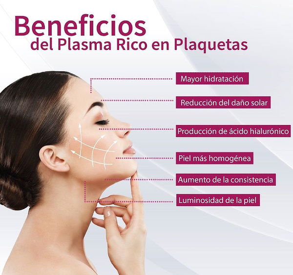 Aplicación de Plasma Rico en Plaquetas FACIAL
