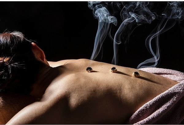 Sesión de acupuntura en Amcci,Santiago