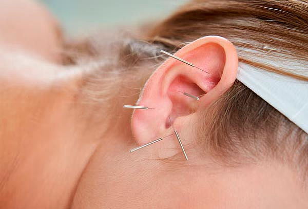 Auriculoterapia para dejar de fumar 