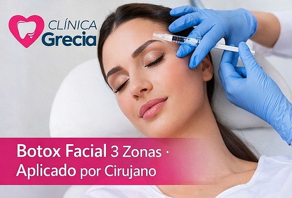 Toxina botulínica en 3 zonas Aplicado por Cirujano Dentista