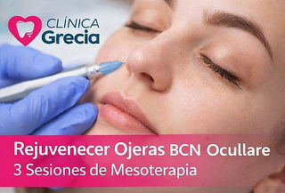 Rejuvenecer Ojeras BCN Ocullare: 3 Sesiones de Mesoterapia