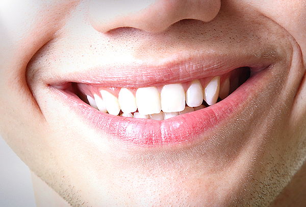 Clínica Rident: Blanqueamiento + Limpieza Dental