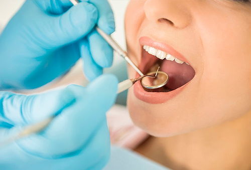 3 Resinas + Limpieza Dental