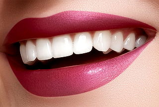 3 Sesiones de Blanqueamiento Dental, Unicentro 3 Sesiones de Blanqueamiento Dental, Unicentro