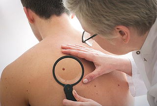 Eliminación de 4 hasta 8 Lunares o Verrugas en Modelia 