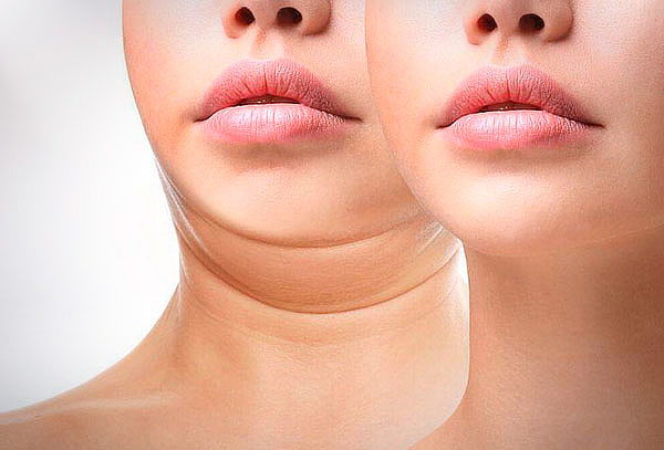 Lipopapada Profesional Sin Cirugía Torre Médica El Tesoro 