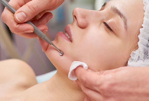 Limpieza Facial + Microdermoabrasion + Lampara emoga