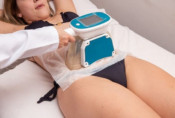 13 Sesiones en 1 Cita de Crio lipolisis 360