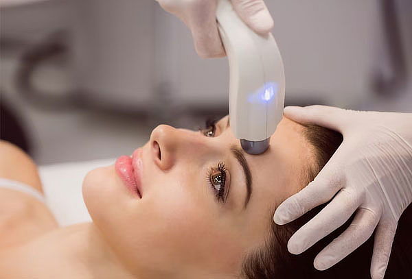 Blanqueamiento facial láser cheap precio