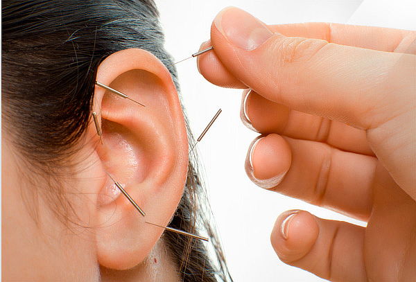 63 Sesiones Auriculoterapia con Drenaje Linfático en Kennedy
