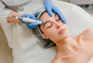 Hollywood Peel - Rejuvenecimiento Facial con Láser