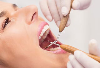 Limpieza Dental Profunda con Retiro de Cálculos 