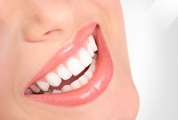 Diseño de Sonrisa 6 Dientes Frontales Colina