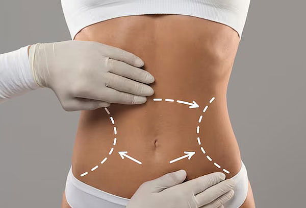 55 Sesiones Reducción Abdomen con Hidrolipoclasia