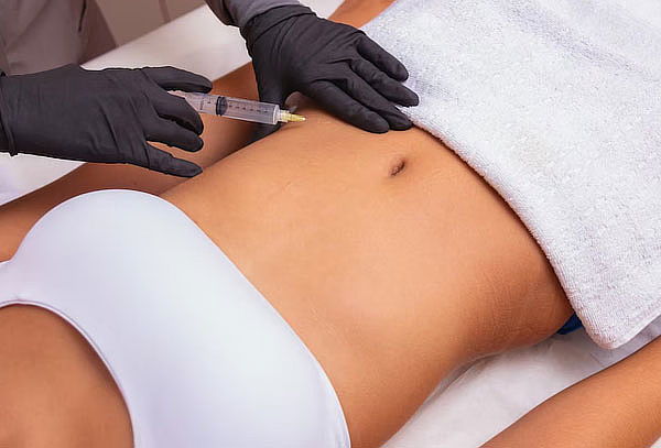 100 Sesiones de Reducción Abdomen con Carboxiterapia