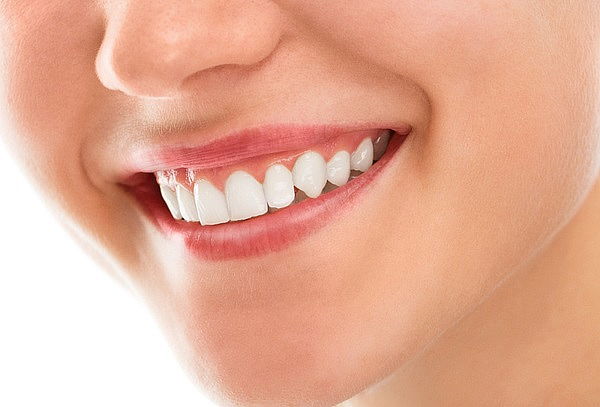 Blanqueamiento Dental (2 Sesiones) + Limpieza + Profilaxis