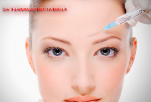 Aplicacion de Botox + Laser Accent 70%