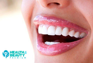 Blanqueamiento dental Led + Remocion de calculos 82%