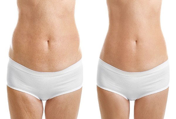 Hidrolipoclasia Flash + Cavitación + Drenaje Linf Reductor 