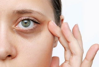 1 Sesión de Aclaración y eliminación de Ojeras Villa Mayor