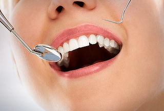 Limpieza Dental Profunda + Detartraje