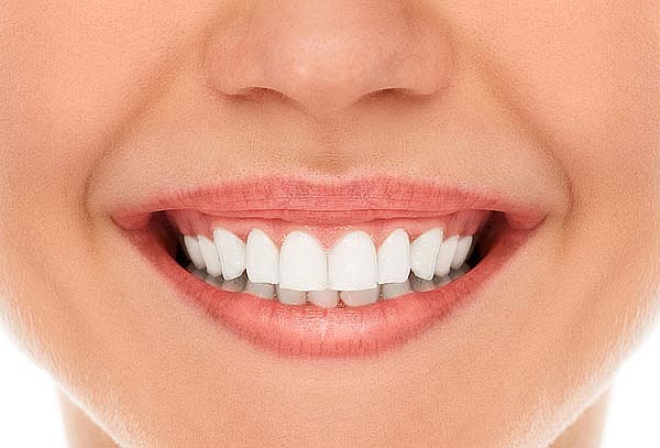 Gingivoplastia o Diseño de Encías en Kennedy