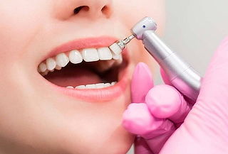 Limpieza dental + Desmanchado + Pulido + Profilaxis