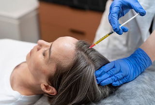 Diagnostico y Plasma Capilar  en el Polo Club