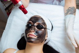 Tratamiento y Sesión de Hollywood Peeling