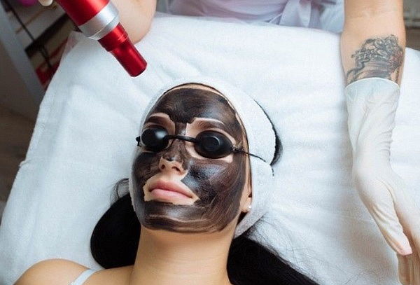 Tratamiento y Sesión de Hollywood Peeling