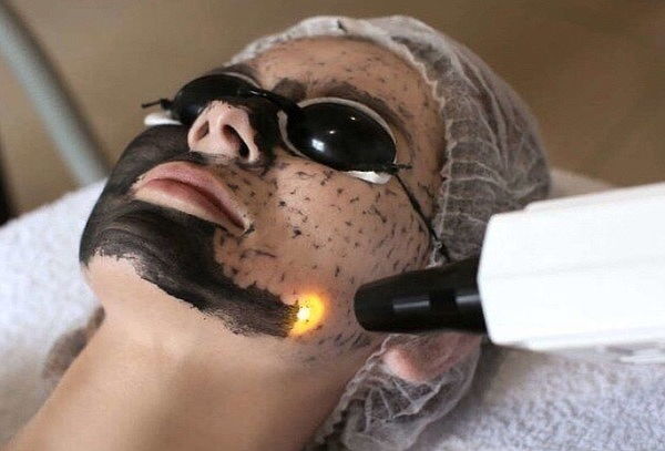 Tratamiento y Sesión de Hollywood Peeling