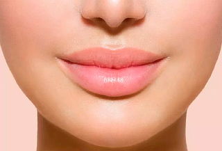 Relleno de Labios con Plasma de 5 Generación en Marsella