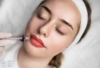 Perfilamiento y relleno de labios 1 víal de ac. hialurónico
