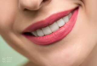 Hidratación de labios con acido hialuronico no reticulado