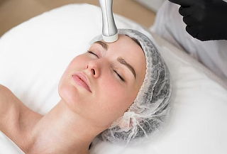Eliminación de manchas faciales con peeling y aparatología