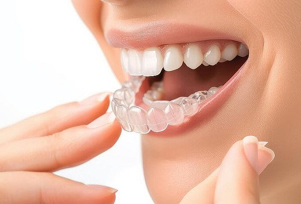 Blanc. dental + Profilaxis + Retenedores transparentes 