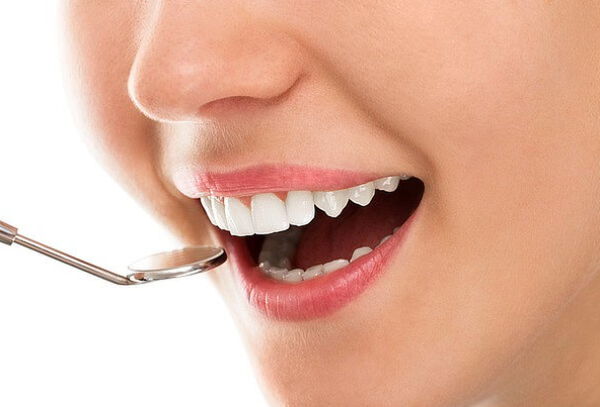 Limpieza Profunda, curetaje, desmanche y profilaxis dental