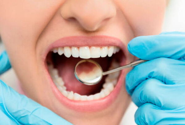 Limpieza Dental Profunda en Sede a Elección