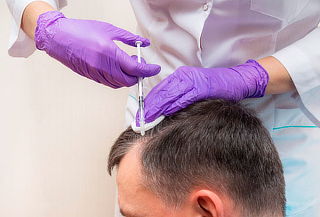 Plasma Capilar: Crecimiento y Detiene la Caída del Cabello