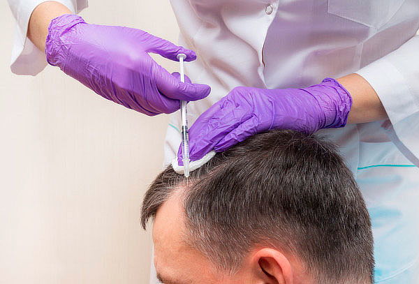 Plasma Capilar: Crecimiento y Detiene la Caída del Cabello